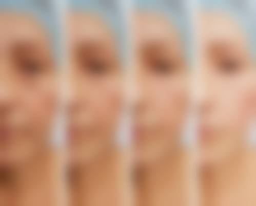 四、宁夏银川慧清雅妍医疗美容医院特色项目