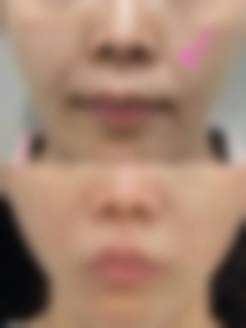 七、荆门市中医医院(烧伤整形外科)预约方式