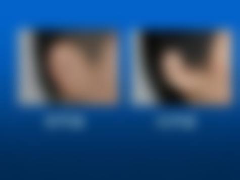 二、南京新莎洞整形医院怎么样？