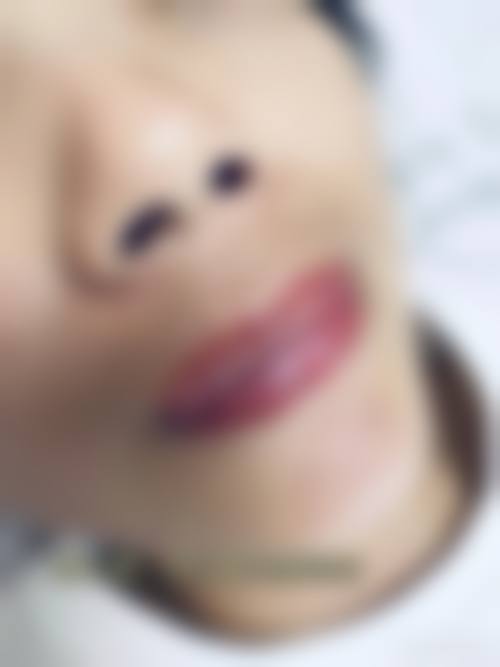 六、郑州张朝蕾整形医院价格表