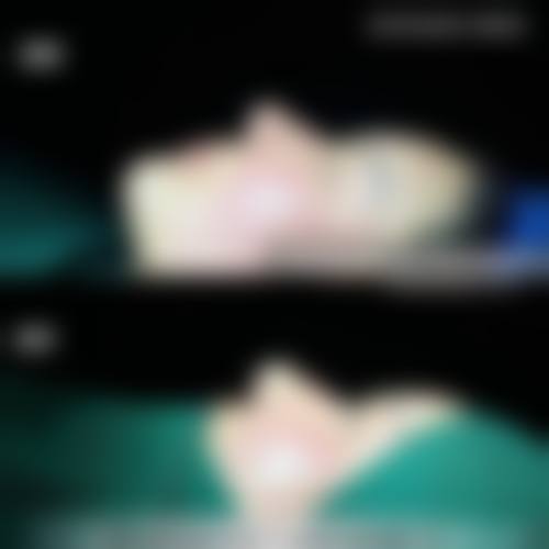 四、镇江璀璨医疗美容诊所特色项目