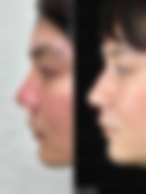 四、吉林市化工医院整形美容科特色项目