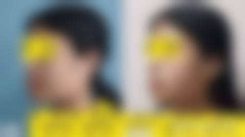 四、荆门市中医医院(烧伤整形外科)特色项目