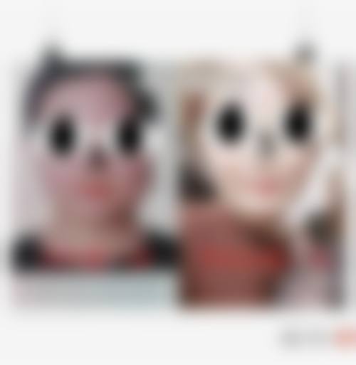 九、杭州西美医疗美容诊所真实的患者评价