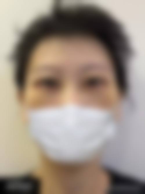 八、宁夏银川慧清雅妍医疗美容医院真实的患者评价