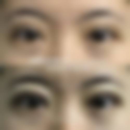 八、上饶尚美医疗美容医院预约方式