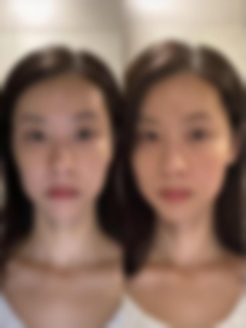 一、常见副作用及应对方式