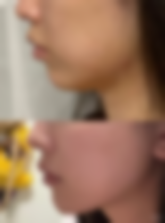 四、大连许英医疗美容诊所特色项目