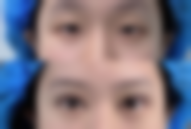 九、郑州张朝蕾整形医院真实的患者评价