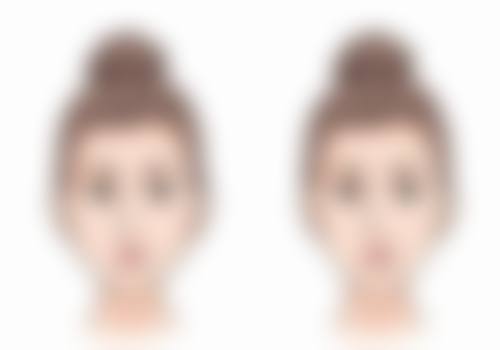 小孩子头上的疤痕会恢复吗？了解恢复关键因素与时间，助孩子疤痕淡化