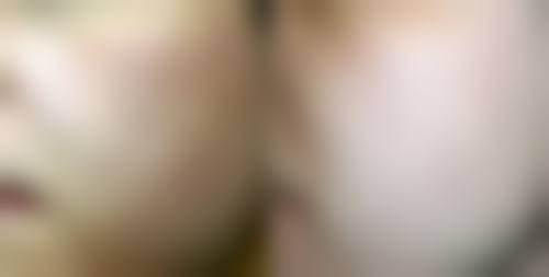 三、六十岁做双眼皮需要关注的问题及解决方案