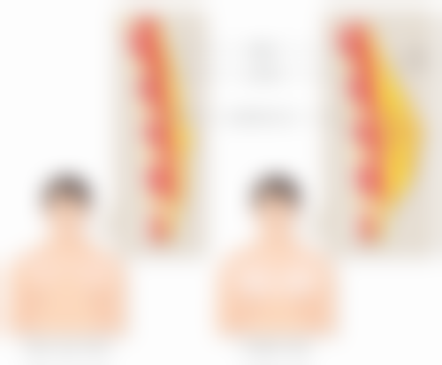 四、眼袋可以睡下去吗?应对不同眼袋的小妙招