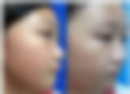 五、济南全好口腔连锁门诊部价格表