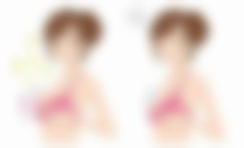 四、埋线双眼皮一个宽一个窄的美学提示