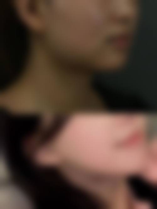 二、烟台新面孔医疗美容诊所怎么样?