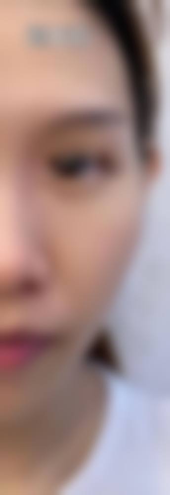 四、云南曲靖华美美莱医疗美容门诊部特色项目