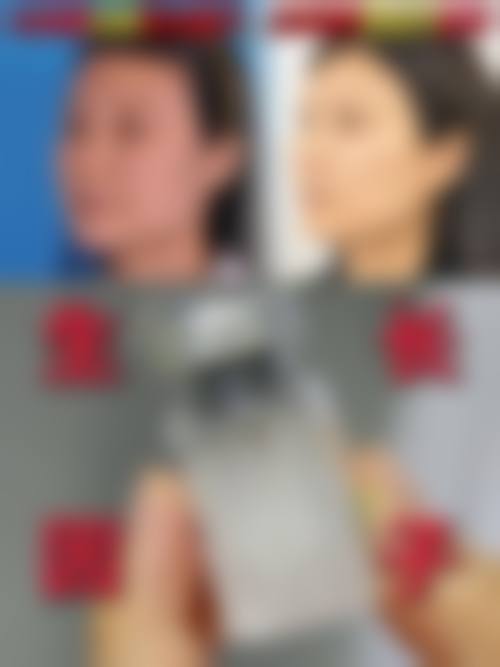 四、崔春晓医疗美容特色项目