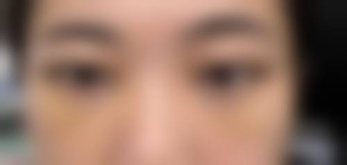 六、烟台鹏爱整形医院价格表