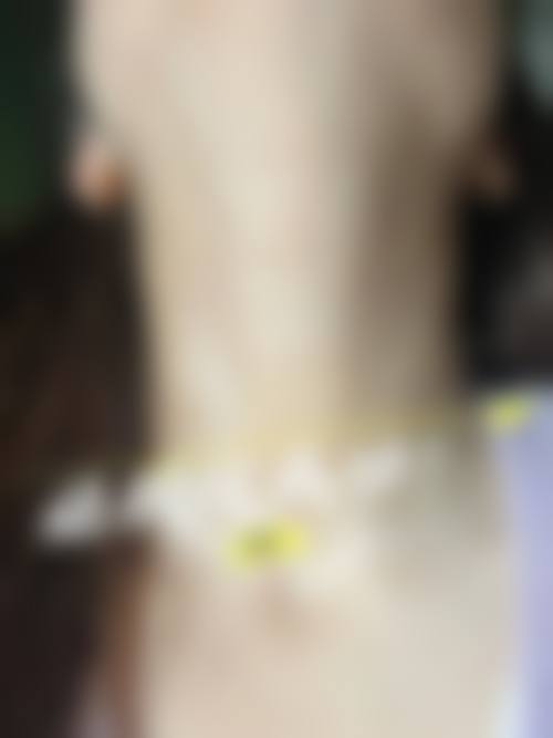 九、大连鑫来美医疗美容整形医院真实的患者评价