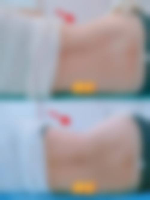 八、昆明美颜成医疗美容诊所真实的患者评价