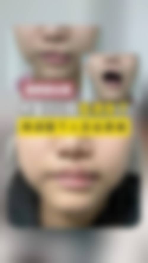 八、天津昱霖整形医院真实的患者评价