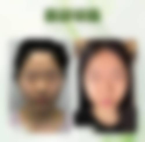 六、承德凯丽医疗美容门诊部价格表