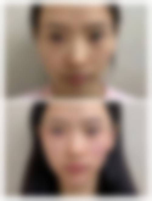 八、沈阳市艾咪整形外科机构真实的患者评价