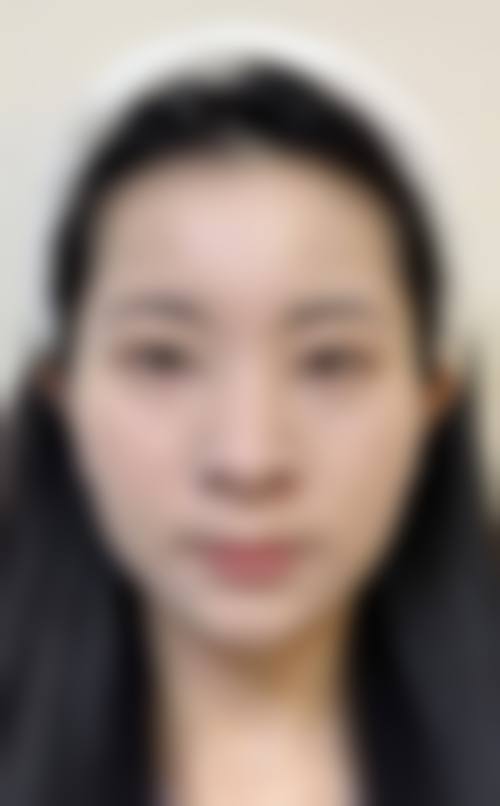 四、包头赵云庆医疗美容诊所特色项目