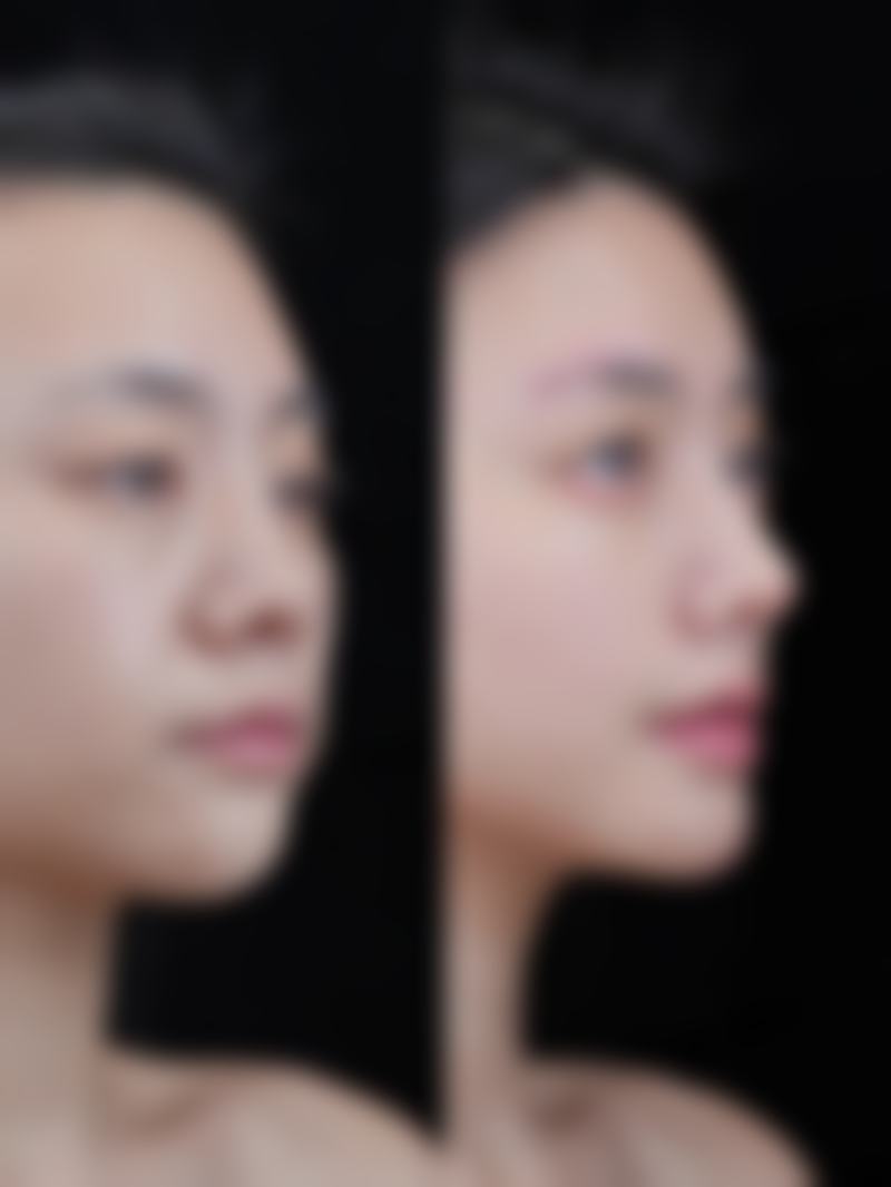 三、日常护理要点