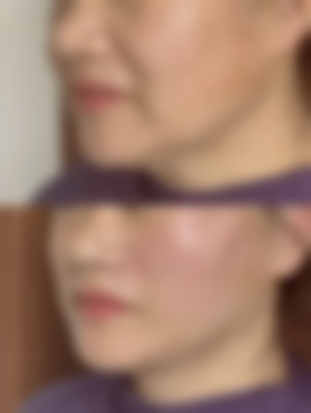 {眼袋可以睡下去吗？了解形成原因与类型，科学判断睡眠对消除眼袋的作用 