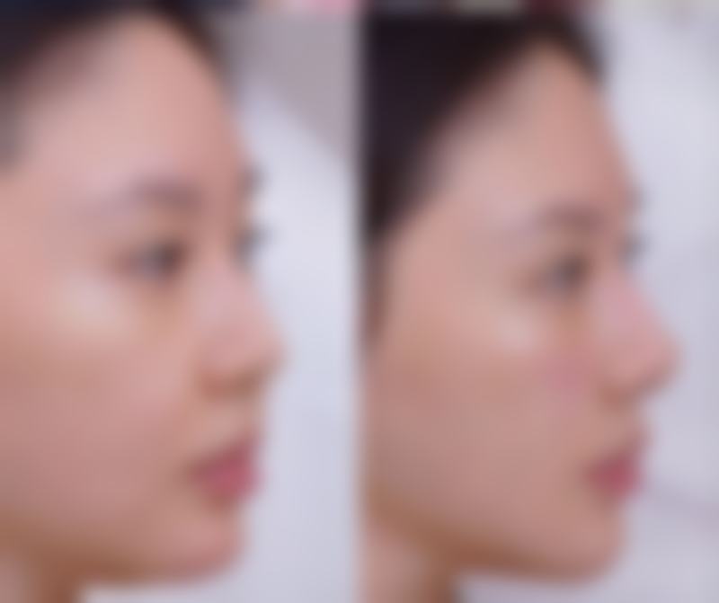 五、成都臻美逆时光医疗美容门诊部价格表