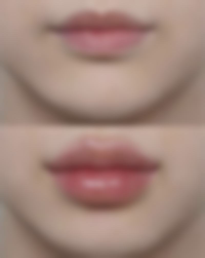 {隆鼻多久过增生期？了解增生阶段特点、护理方法助你顺利度过恢复期