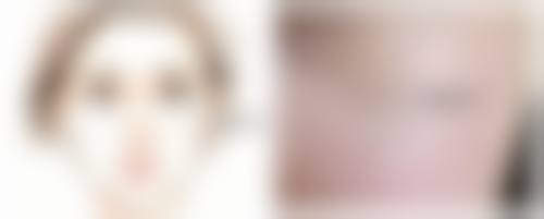 四、涂什么吸收眼袋脂肪：不同类型眼袋的治疗方案对比