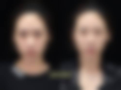 四、成都华欣美辰医疗美容医院特色项目