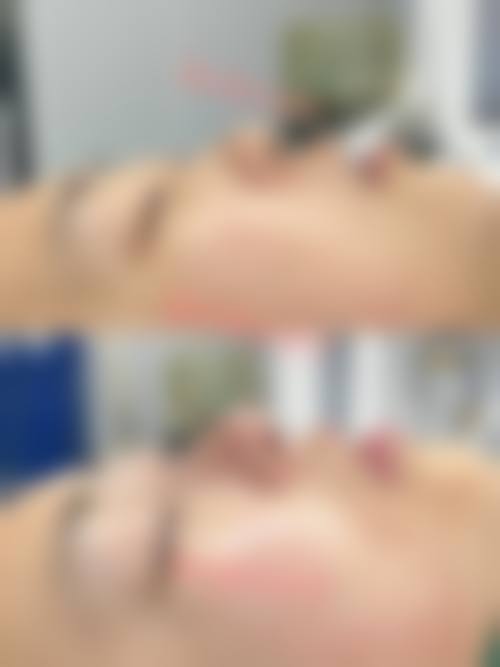 四、郴州爱思特医疗美容门诊部特色项目