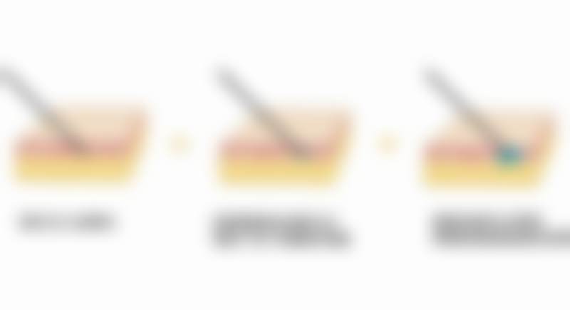 三、余文林技术优势