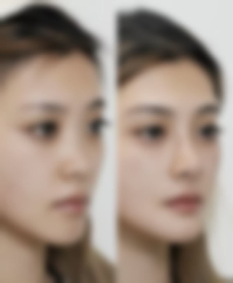 六、郴州爱思特医疗美容门诊部价格表