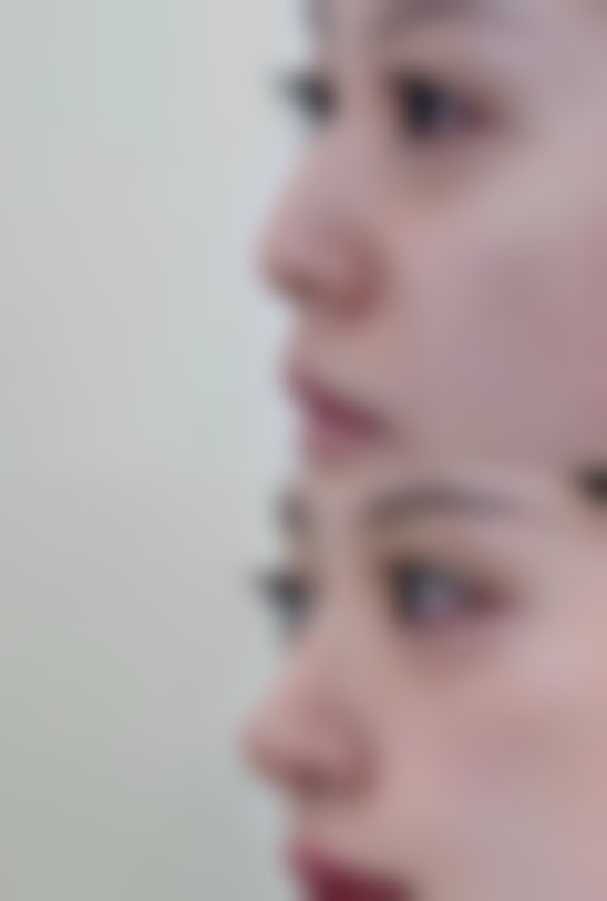 四、日常护理关键点:辅助抑制疤痕增生