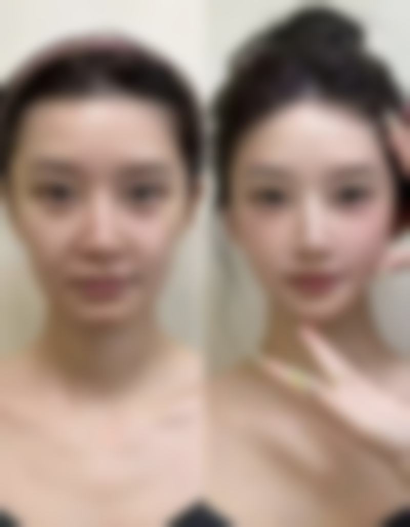 二、郴州爱思特医疗美容门诊部怎么样?