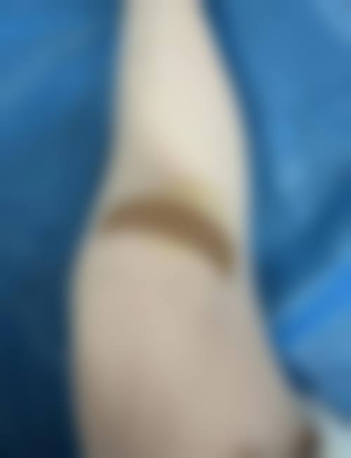 八、长沙逸韩医疗美容医院预约方式