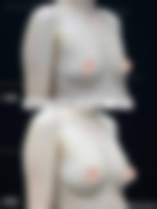 九、张掖市人民医院美容整形科真实的患者评价