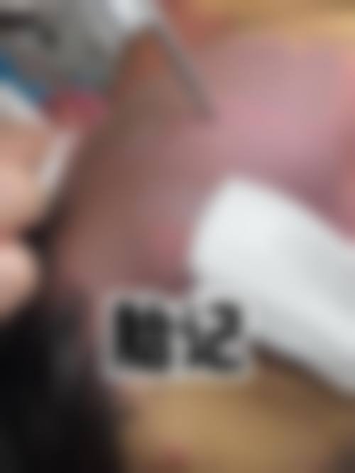 八、佛山禅城屋户整形医院真实的患者评价