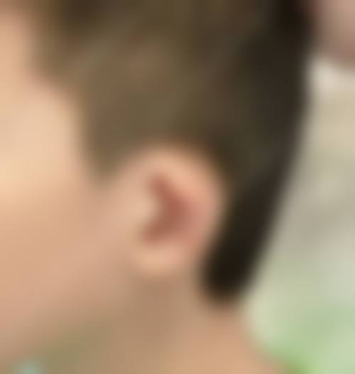 九、盘锦韩后医疗美容诊所真实的患者评价