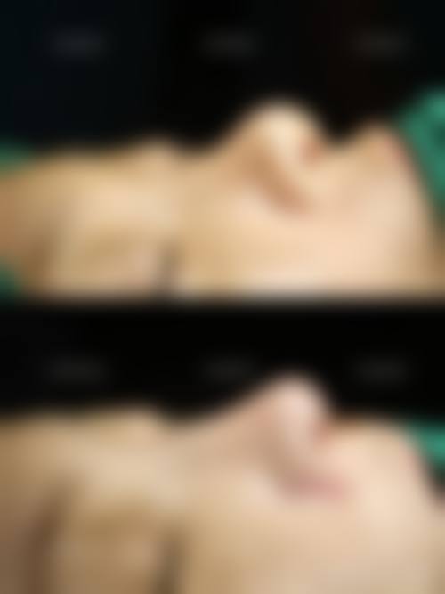 八、张掖市人民医院美容整形科预约方式