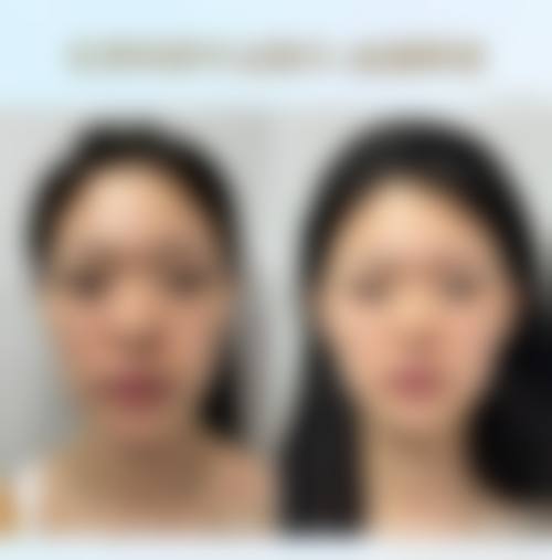 九、长沙逸韩医疗美容医院真实的患者评价