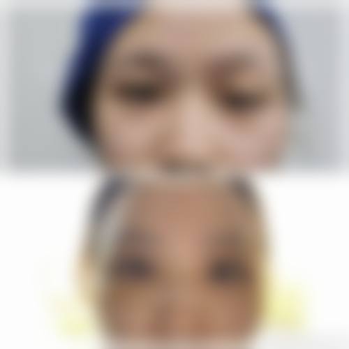 五、佛山禅城屋户整形医院价格表