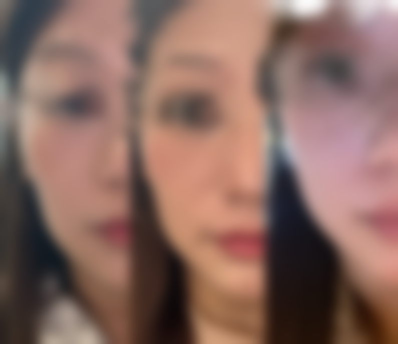 {女人隆胸对身体好不好？了解利弊与风险，助你理性开启美丽蜕变之旅！ 