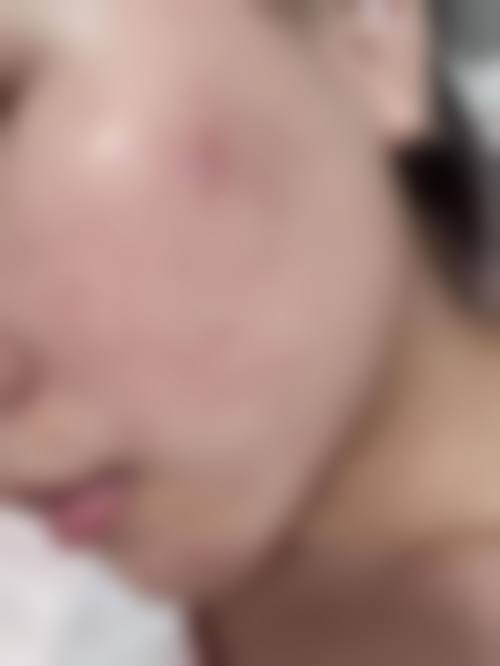 九、海南煌越植发医疗美容门诊部真实的患者评价