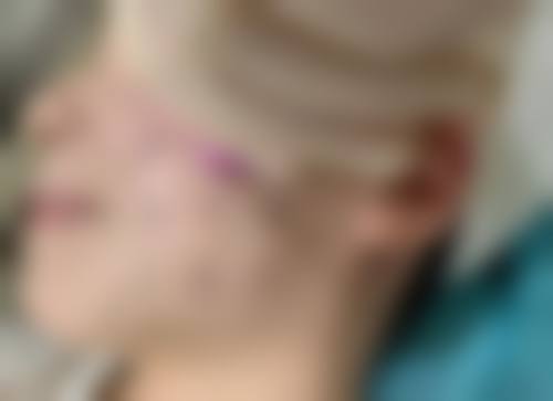 六、清华大学第一附属医院(皮肤美容科)价格表