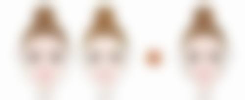 四、割眼袋内切修复期间的其他注意事项